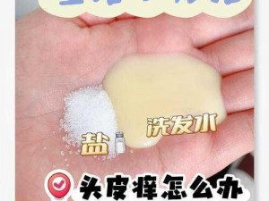 吃异维 a 酸后痒、头皮屑多怎么办？试试[商品名]