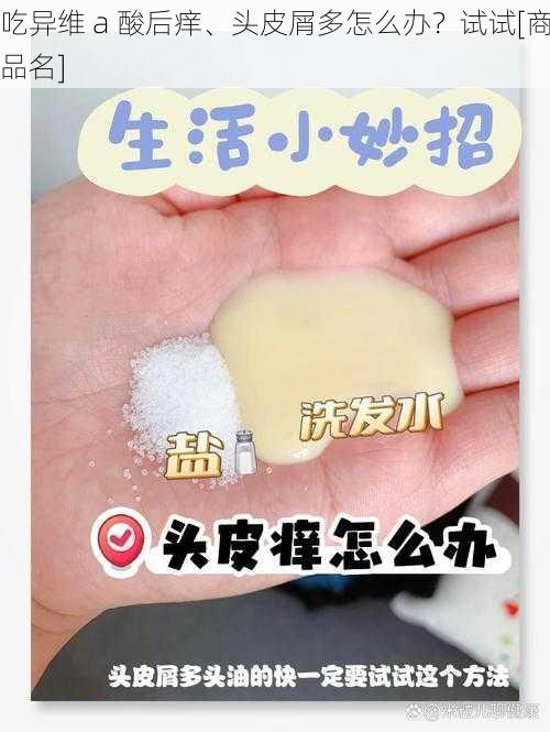 吃异维 a 酸后痒、头皮屑多怎么办？试试[商品名]